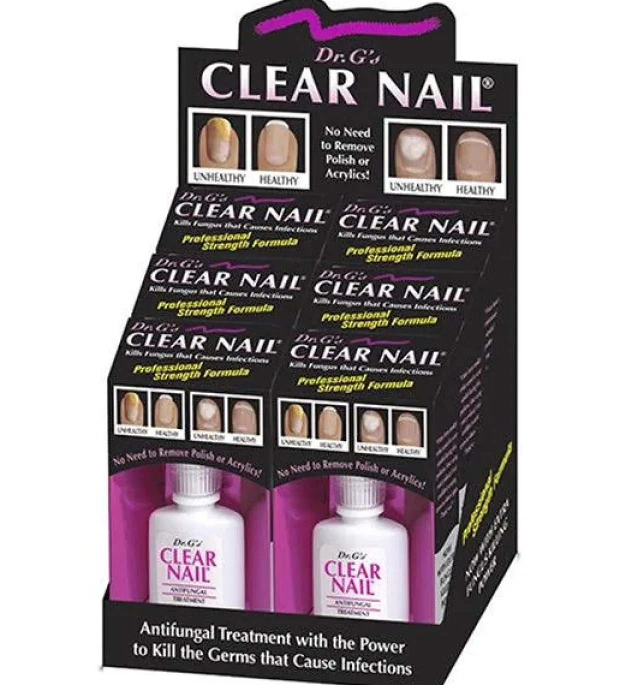 Dr. G's Clear Nail Antifungal Treatment, .5 fl. oz. - 6 Piece Display